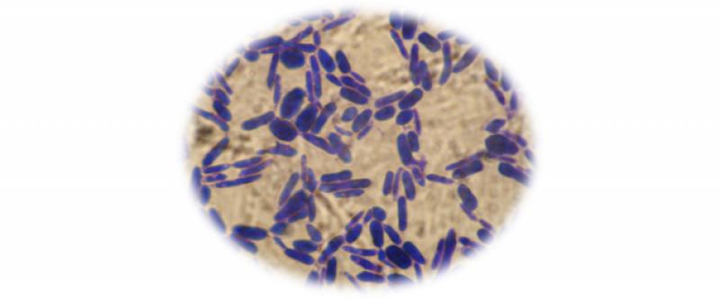 Comparison of Brettanomyces yeast presence in young red wines in two consecutive vintages